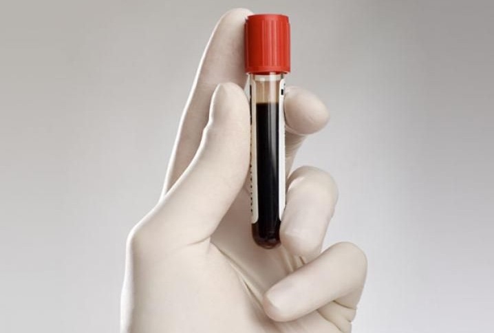 О результатах клинических исследований крови животных