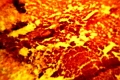 Выявлены изменения характерные для злокачественной опухоли фибросаркомы