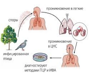 Орнитоз