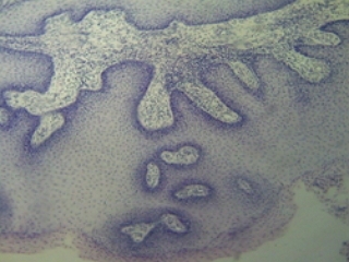 Папиллома кожи собаки
