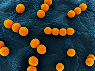 Патогенные культуры: Staphylococcus aureus, Streptococcus, серогруппа D.