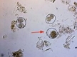 Цистоизоспорозы (Cystoisosporoses)