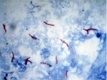 Туберкулез птиц