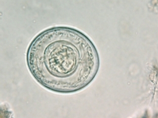 Гименолепидоз (hymenolepidosis)