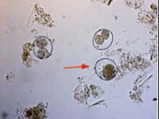 Цистоизоспорозы (Cystoisosporoses)