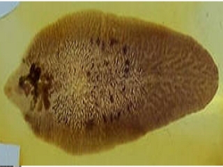 Дикроцелиоз (семейству Dicrocoeliidae) 