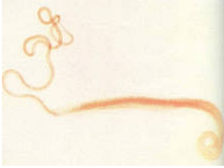Трихоцефалез (сем Trichocephalidae)