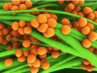 Патогенные культуры Staphylococcus aureus, Enterobacter cloacae.