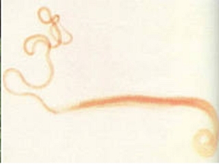 Трихоцефалез (сем Trichocephalidae)