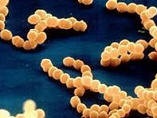 Патогенные культуры: Staphylococcus aureus, Enterococcus faecalis, самоагглютинирующая Escherichia coli.