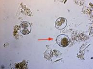Цистоизоспорозы (Cystoisosporoses)