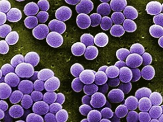 Патогенные культуры: Staphylococcus aureus, Escherichia coli 015, Enterococcus faecalis.