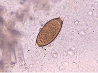 Трихоцефалез (сем Trichocephalidae) 