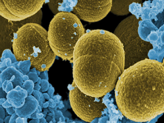 Патогенные культуры Staphylococcus aureus, Enterococcus faecalis