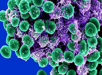 Патогенная культура стафилококка Staphylococcus aureus.