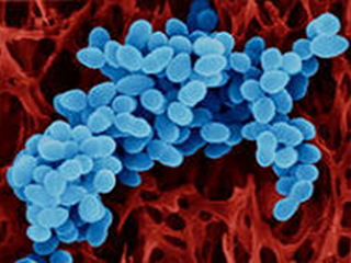 Патогенная культура Staphylococcus aureus.