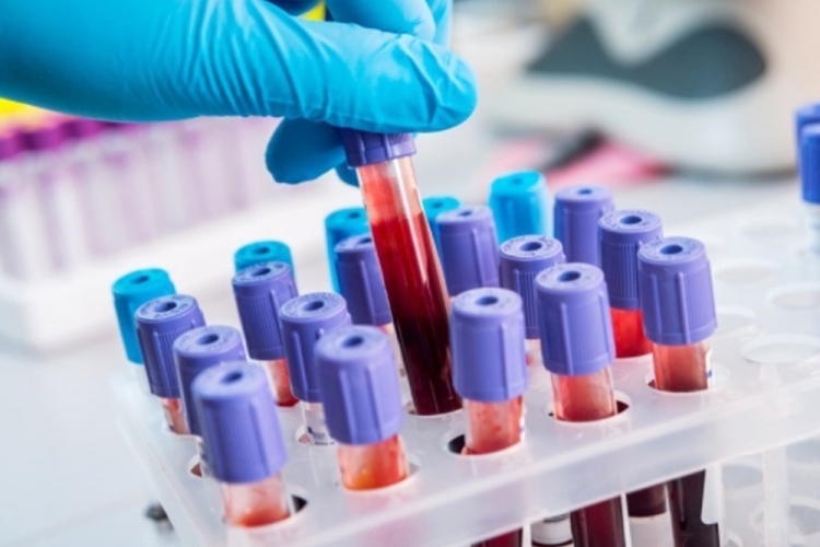 Биохимический анализ крови – важнейший диагностический метод исследования нарушений обменных процессов в организме животных.
