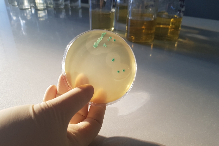 Меры профилактики листериоза