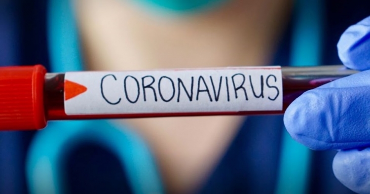 ФГБУ «Краснодарская МВЛ» сообщает о возможности проведения исследований на коронавирус (COVID-19) у животных