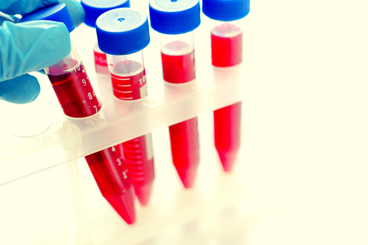 Биохимический анализ крови – важнейший диагностический метод исследования нарушений обменных процессов в организме животных