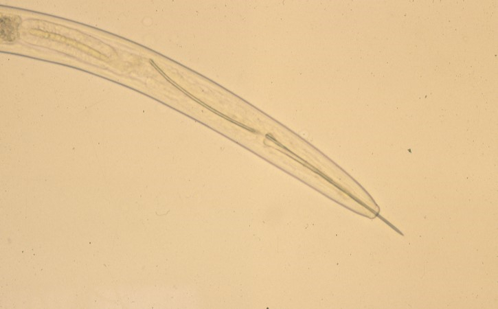 Американская группа нематод рода Xiphinema sp. (кинжальные нематоды)