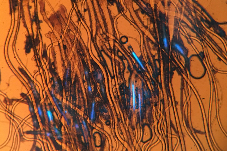 В образце волос котёнка обнаружен возбудитель микроспории