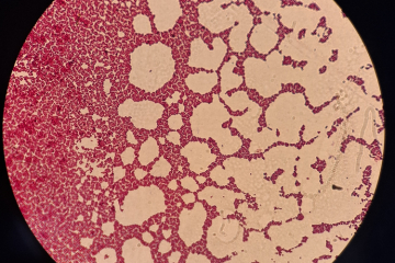 Обнаружена условно-патогенная микрофлора у попугая