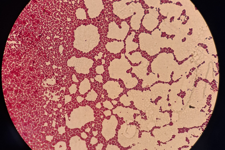 Обнаружена условно-патогенная микрофлора у попугая