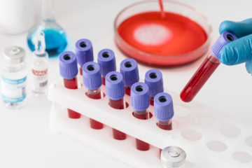 ФГБУ «ВНИИЗЖ» ВПЕРВЫЕ ПРОВЕДЕТ РАУНДЫ МСИ ПО НОВЫМ НАПРАВЛЕНИЯМ ДИАГНОСТИКИ БЕШЕНСТВА