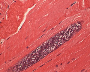 Саркоцистоз животных