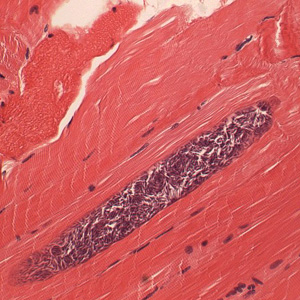 Саркоцистоз животных